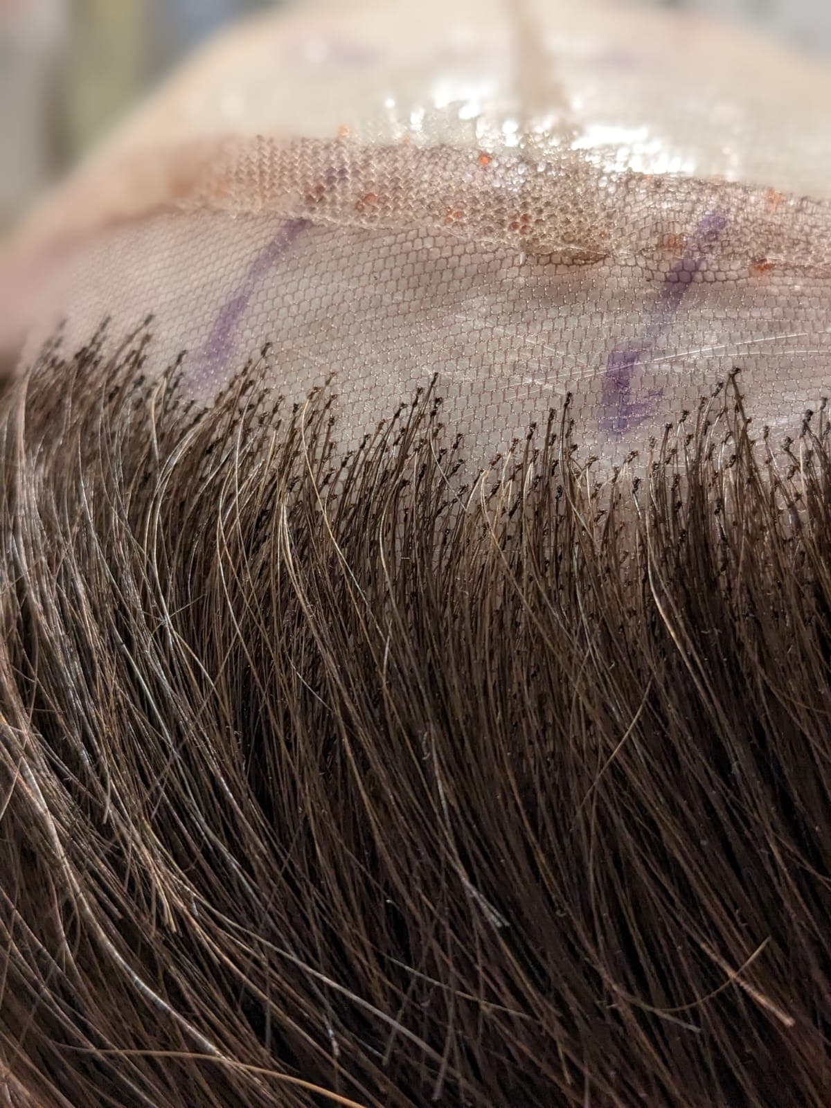 Perücke, Berlin, Haarausfall, Alopezie, kreisrunder Haarausfall, Alopecia totalis, Alopecia areata, Alopecia Androgenetica, Haare, Echthaar, Haarteil, Lace, Montur, Wig, Lacewig, Hair, Haarlinie, Full Lace, Lace Front, Knüpfen, Reparatur, 100% Echthaar, knüpfknoten, Handwerk,